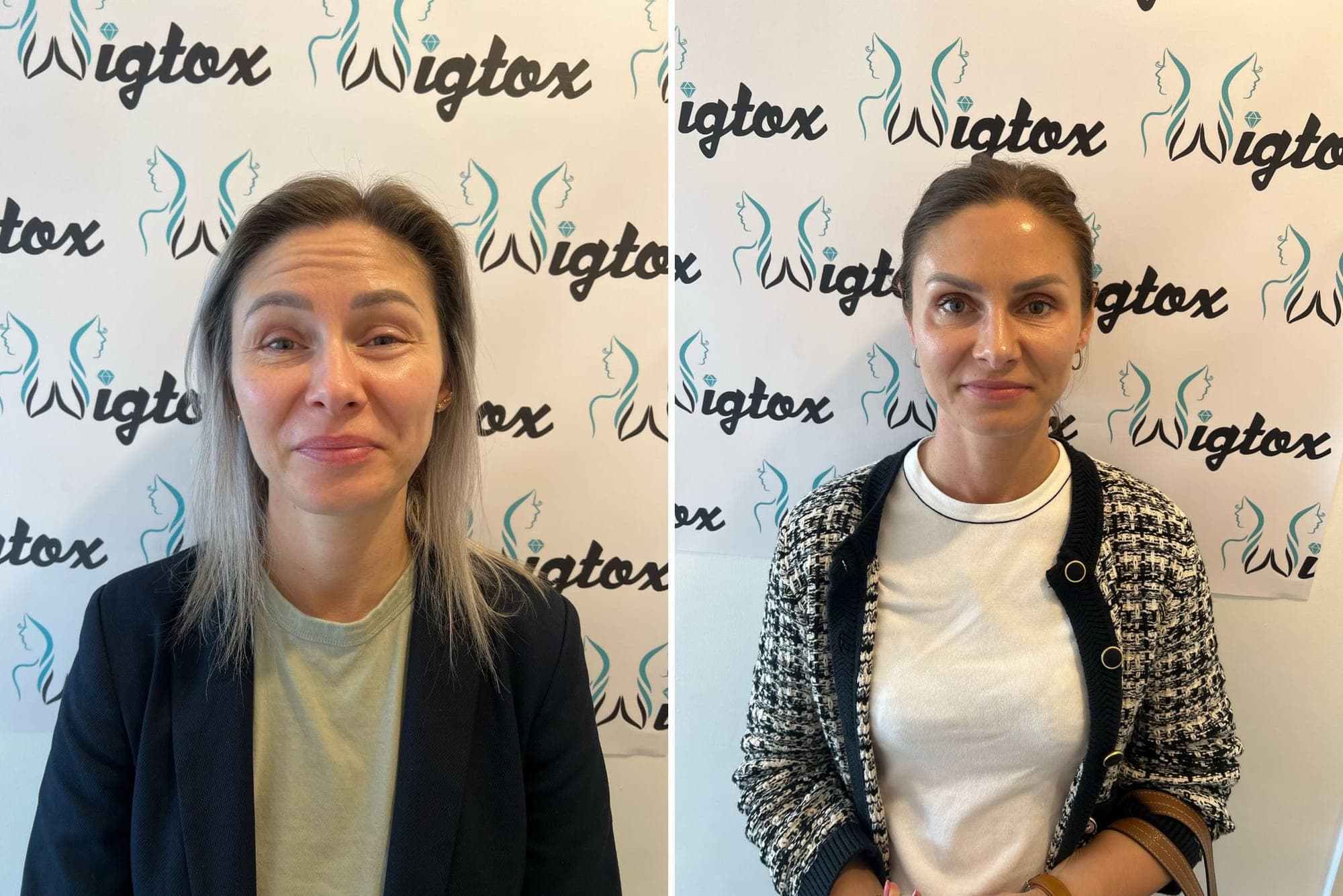 Cover image for No More Lines with Botox Wigtox South Yorkshire